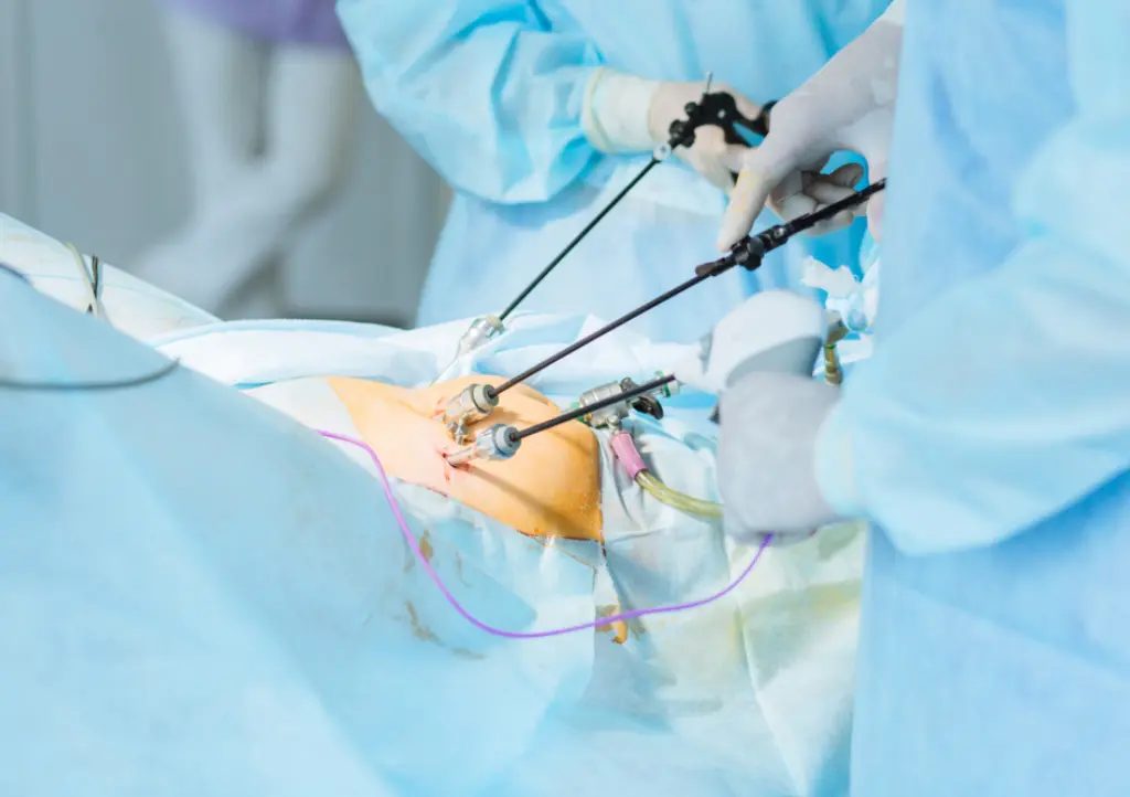 Advanced Hystero-Laparoscopy - Genesis IVF | Best Laparoscopic Surgeon in Chennai