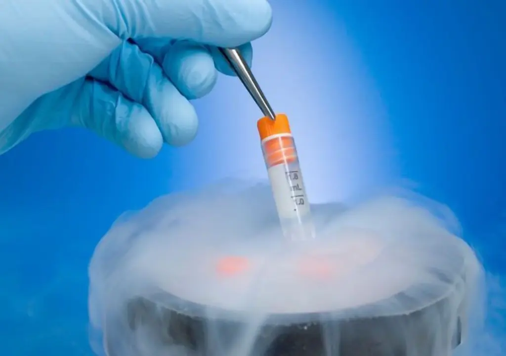 Cryopreservation in Chennai | Genesis IVF
