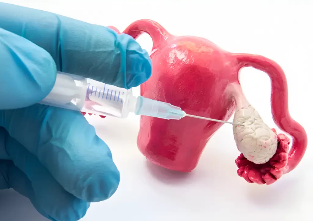 Ovarian Stimulation - Genesis IVF, advanced fertility centre in Chennai