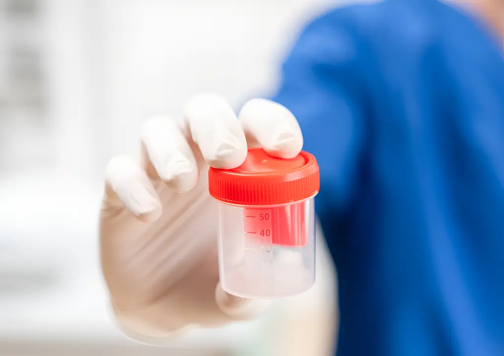 Sperm Banks in Chennai